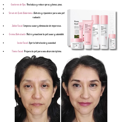 KIT X7 Productos -  Rutina de Rosas con Ácido Hialurónico Bioaqua🌸 Envio Gratis + Pago Contra Entrega🚚